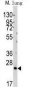BH3 Interacting Domain Death Agonist antibody, abx027196, Abbexa, Western Blot image 