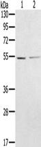 N-Myristoyltransferase 2 antibody, CSB-PA158660, Cusabio, Western Blot image 