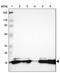 Patatin Like Phospholipase Domain Containing 4 antibody, PA5-51986, Invitrogen Antibodies, Western Blot image 