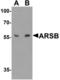 Arylsulfatase B antibody, orb314200, Biorbyt, Western Blot image 