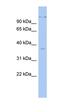 Paired Box 4 antibody, orb329686, Biorbyt, Western Blot image 