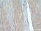 Twinkle protein, mitochondrial antibody, 13435-1-AP, Proteintech Group, Immunohistochemistry paraffin image 