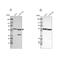 Glucose-6-Phosphate Dehydrogenase antibody, NBP1-89805, Novus Biologicals, Western Blot image 
