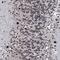 RUN And FYVE Domain Containing 2 antibody, HPA039792, Atlas Antibodies, Immunohistochemistry frozen image 