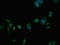 Ceramide Synthase 5 antibody, LS-C674491, Lifespan Biosciences, Immunofluorescence image 
