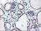 TBC1 Domain Family Member 21 antibody, M14405, Boster Biological Technology, Immunohistochemistry paraffin image 