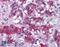 MER Proto-Oncogene, Tyrosine Kinase antibody, 45-885, ProSci, Enzyme Linked Immunosorbent Assay image 