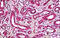 Lysosomal acid phosphatase antibody, MBS246116, MyBioSource, Immunohistochemistry frozen image 