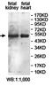 Potassium Channel Tetramerization Domain Containing 18 antibody, orb78235, Biorbyt, Western Blot image 