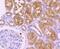 Histone Deacetylase 6 antibody, NBP2-67891, Novus Biologicals, Immunohistochemistry paraffin image 