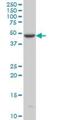 Iroquois Homeobox 5 antibody, H00010265-M06, Novus Biologicals, Western Blot image 