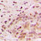 Mitogen-Activated Protein Kinase 6 antibody, LS-C354065, Lifespan Biosciences, Immunohistochemistry paraffin image 