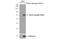 SMAD Family Member 4 antibody, GTX112980, GeneTex, Western Blot image 