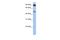 Solute Carrier Family 45 Member 2 antibody, A02543, Boster Biological Technology, Western Blot image 