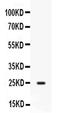 CD9 Molecule antibody, PA5-79012, Invitrogen Antibodies, Western Blot image 