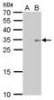 Collagen Type XI Alpha 2 Chain antibody, GTX629481, GeneTex, Western Blot image 