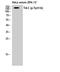 Neurotrophic Receptor Tyrosine Kinase 3 antibody, A02502Y516, Boster Biological Technology, Western Blot image 