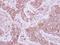 Eukaryotic Translation Elongation Factor 1 Delta antibody, LS-C155318, Lifespan Biosciences, Immunohistochemistry frozen image 