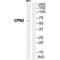 Carboxypeptidase N Subunit 2 antibody, A05815, Boster Biological Technology, Western Blot image 