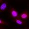 Ribosomal Protein S6 Kinase A1 antibody, MAB79672, Novus Biologicals, Immunofluorescence image 