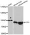 Ubiquitin Specific Peptidase 4 antibody, abx126770, Abbexa, Western Blot image 