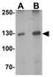 Tyrosine Kinase 2 antibody, GTX31515, GeneTex, Western Blot image 