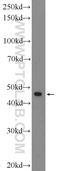 Arrestin Domain Containing 3 antibody, 25060-1-AP, Proteintech Group, Western Blot image 