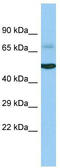 Acyl-CoA Oxidase Like antibody, TA332182, Origene, Western Blot image 