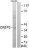 Olfactory Receptor Family 5 Subfamily P Member 2 antibody, TA316044, Origene, Western Blot image 