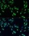 SMAD Family Member 7 antibody, LS-C747455, Lifespan Biosciences, Immunofluorescence image 