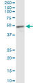 Methyl-CpG Binding Protein 2 antibody, LS-B5462, Lifespan Biosciences, Western Blot image 