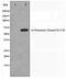 Potassium Voltage-Gated Channel Subfamily C Member 2 antibody, TA347462, Origene, Western Blot image 