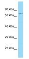 Acyl-CoA Synthetase Bubblegum Family Member 1 antibody, GTX16561, GeneTex, Western Blot image 