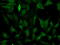 Fumarate Hydratase antibody, GTX84499, GeneTex, Immunofluorescence image 