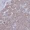 Calcium Release Activated Channel Regulator 2B antibody, NBP1-91863, Novus Biologicals, Immunohistochemistry paraffin image 