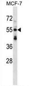 Syntrophin Beta 2 antibody, AP53969PU-N, Origene, Western Blot image 
