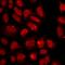 Unc-51 Like Kinase 4 antibody, LS-C668407, Lifespan Biosciences, Immunofluorescence image 