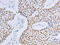 DNA replication licensing factor MCM2 antibody, CSB-PA578532, Cusabio, Immunohistochemistry paraffin image 