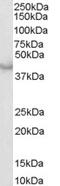 Caspase 4 antibody, STJ70593, St John