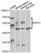 Receptor Interacting Serine/Threonine Kinase 3 antibody, A5431, ABclonal Technology, Western Blot image 