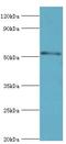 Mothers against decapentaplegic homolog 9 antibody, LS-C376626, Lifespan Biosciences, Western Blot image 