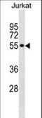 Splicing factor 3A subunit 2 antibody, LS-C156055, Lifespan Biosciences, Western Blot image 