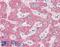 Alpha-1-antitrypsin antibody, LS-B3128, Lifespan Biosciences, Immunohistochemistry paraffin image 