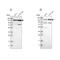 Ubiquitin Specific Peptidase 28 antibody, NBP1-82905, Novus Biologicals, Western Blot image 