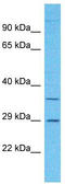 Olfactory Receptor Family 2 Subfamily A Member 7 antibody, TA337484, Origene, Western Blot image 