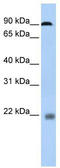 Nuclear Factor Of Activated T Cells 1 antibody, TA343584, Origene, Western Blot image 