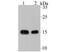 VAMP1 antibody, A05982-2, Boster Biological Technology, Western Blot image 