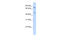 ERCC Excision Repair 8, CSA Ubiquitin Ligase Complex Subunit antibody, 27-117, ProSci, Western Blot image 