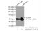 Rho Guanine Nucleotide Exchange Factor 5 antibody, 11379-1-AP, Proteintech Group, Immunoprecipitation image 