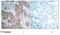 Insulin Like Growth Factor 1 Receptor antibody, GTX79046, GeneTex, Immunohistochemistry paraffin image 